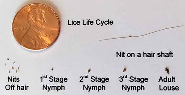 Life cycle of a louse Life cycle of a louse